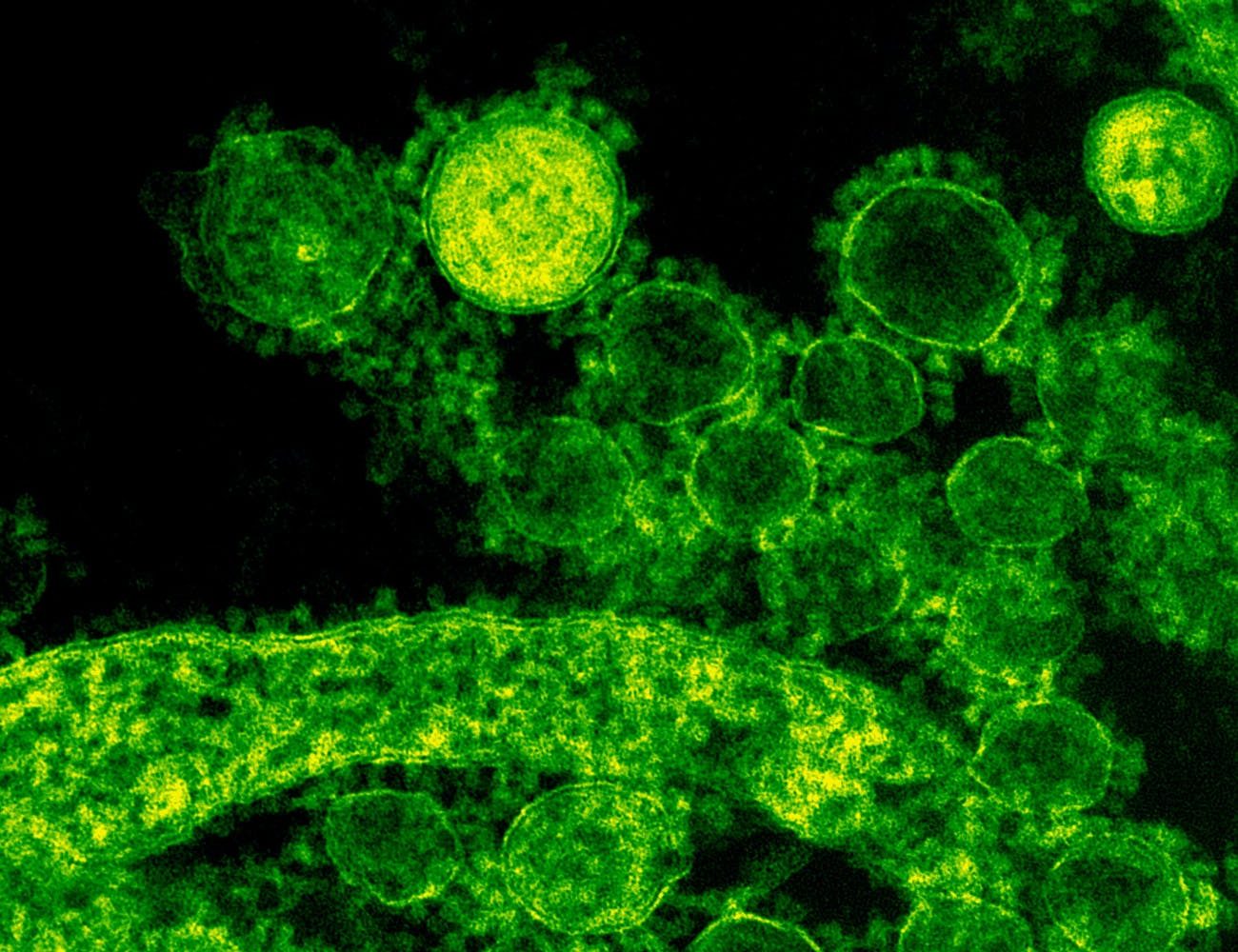 microscopic shot of a virus